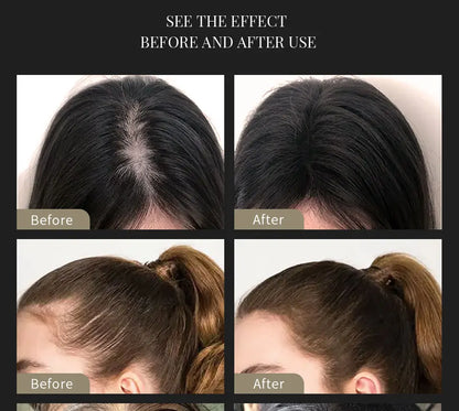 SEVICH Hair Building Fiber Set