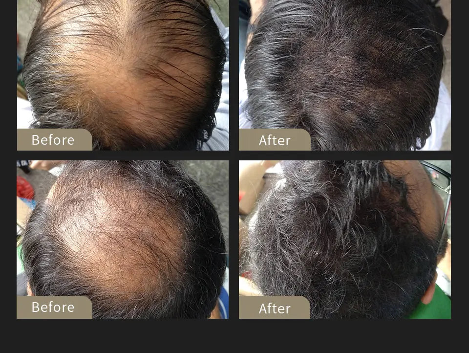 SEVICH Hair Building Fiber Set